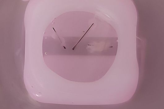 3D culture of hair follicles with three hairs