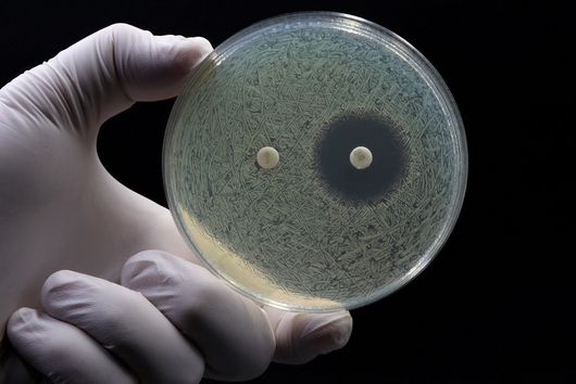 Antibiotic disc test to determine whether bacteria are resistant to certain antibiotics.