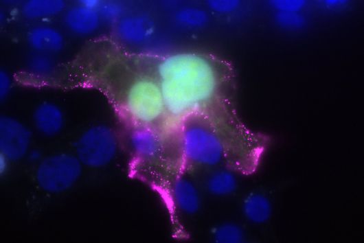 Microscopic image of cells with blue cell nuclei and green and magenta-colored structures
